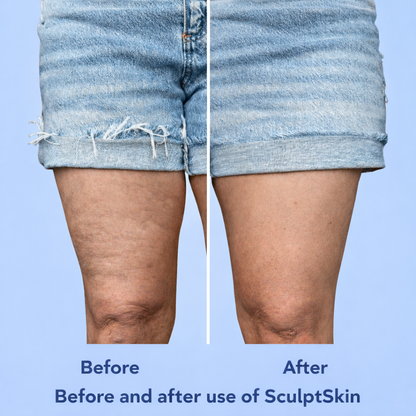 SCULPTSKIN TAPE PACK OF 10